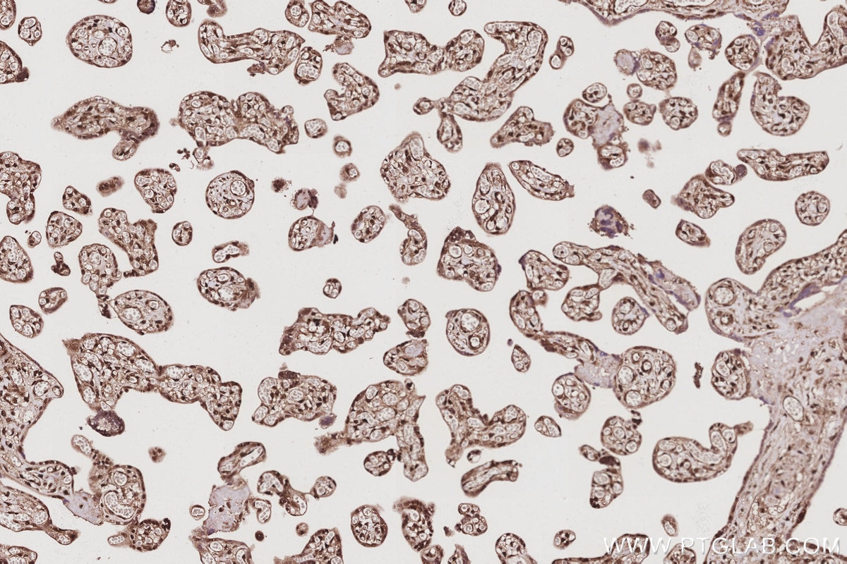 Immunohistochemistry (IHC) staining of human placenta tissue using SBDS Monoclonal antibody (67200-1-Ig)