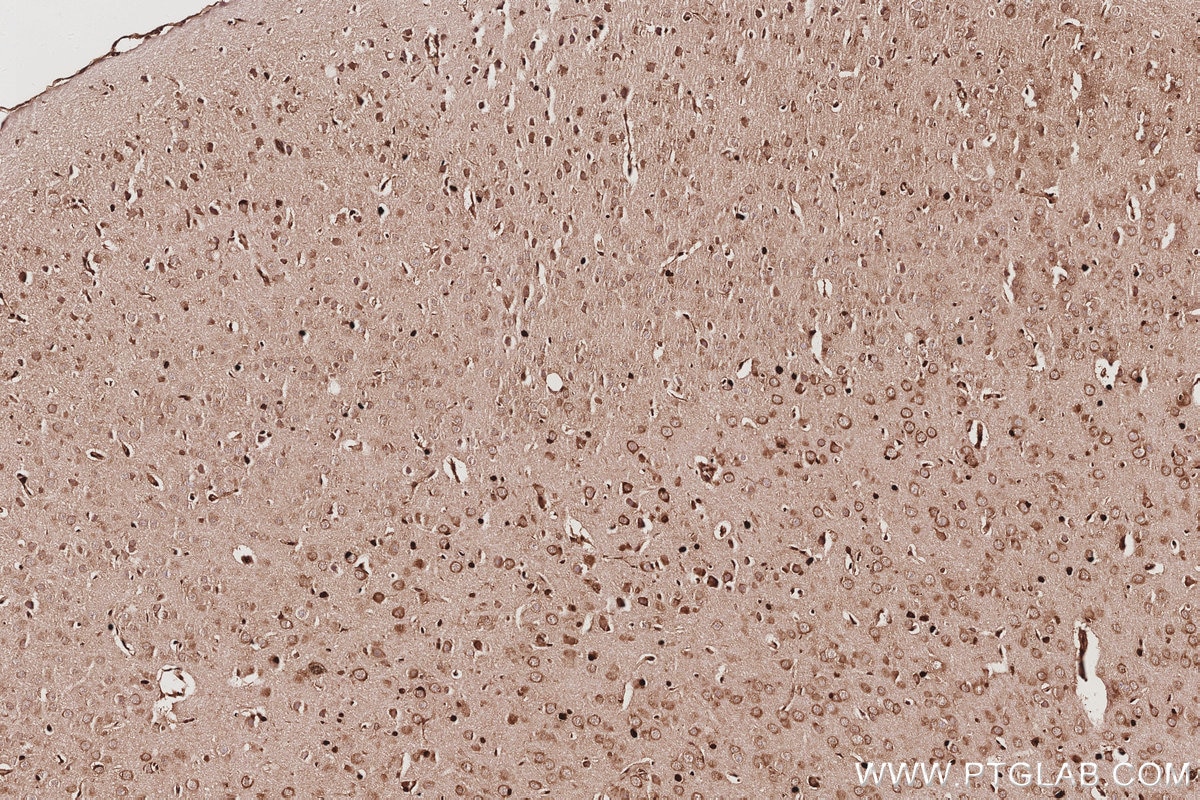 Immunohistochemistry (IHC) staining of mouse brain tissue using SBDS Monoclonal antibody (67200-1-Ig)