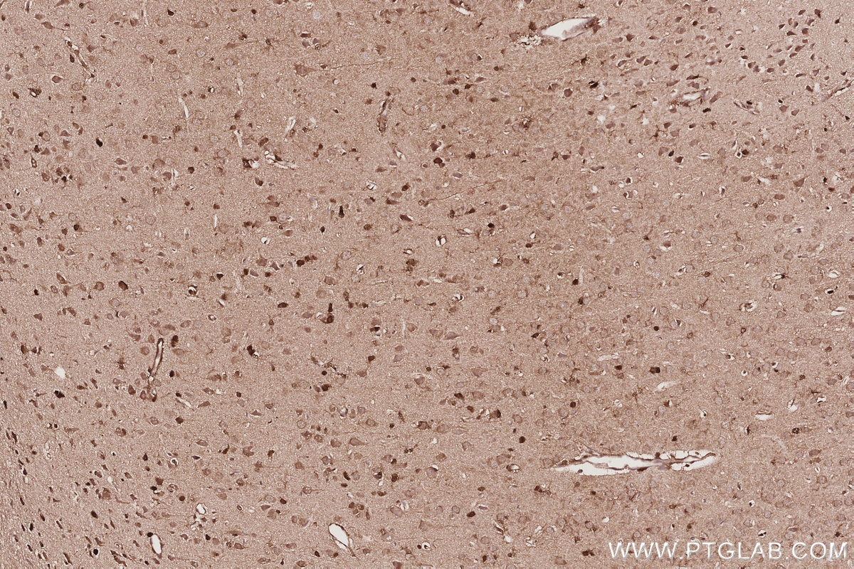 Immunohistochemistry (IHC) staining of rat brain tissue using SBDS Monoclonal antibody (67200-1-Ig)