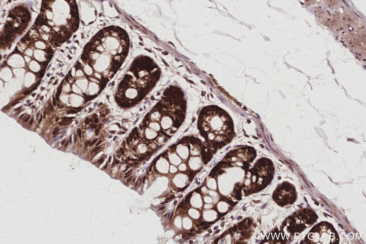 Immunohistochemistry (IHC) staining of rat colon tissue using SBDS Monoclonal antibody (67200-1-Ig)