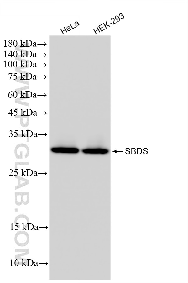 WB analysis using 67200-1-Ig Western Blot (WB) analysis of various lysates using SBDS Monoclonal antibody (67200-1-Ig)