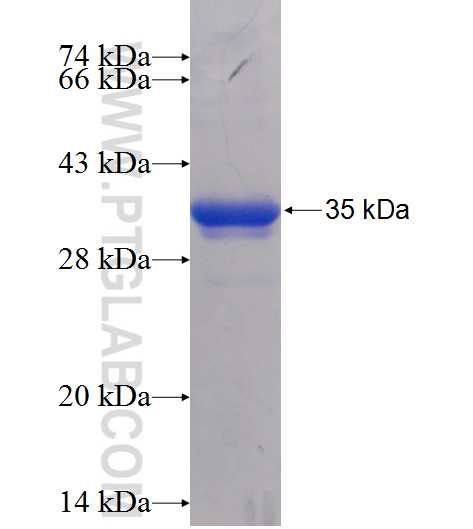 SBDS fusion protein Ag11731 SDS-PAGE