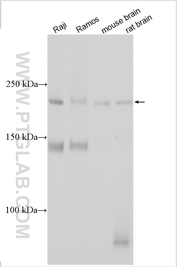 WB analysis using 33515-1-AP Western Blot (WB) analysis of various lysates using SBF1 Polyclonal antibody (33515-1-AP)