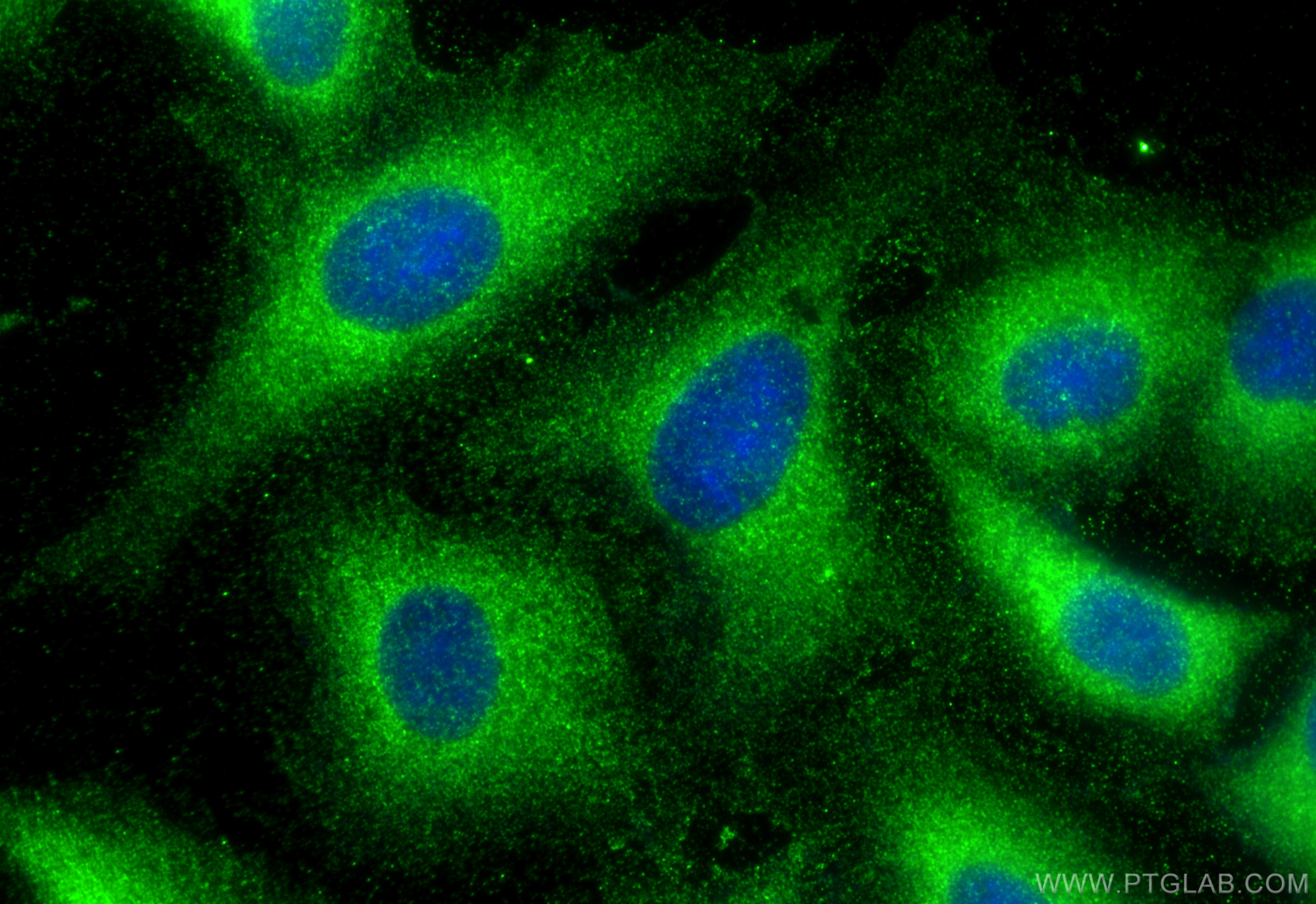 Immunofluorescence (IF) / fluorescent staining of A549 cells using SBK2 Polyclonal antibody (32117-1-AP)