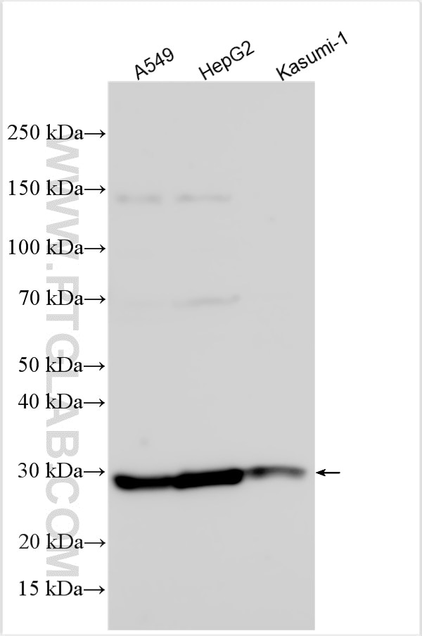 SBK2