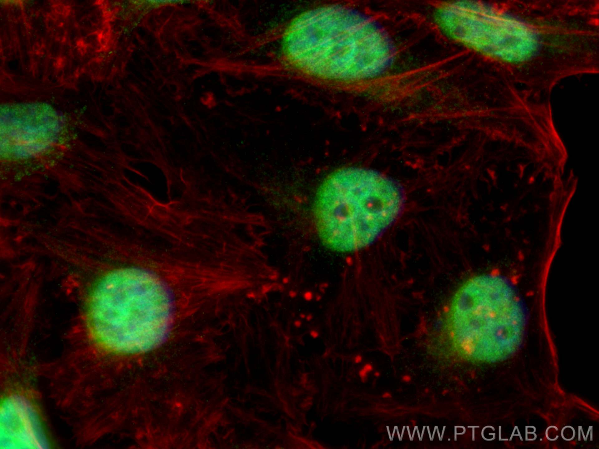 Immunofluorescence (IF) / fluorescent staining of HeLa cells using SBNO1 Polyclonal antibody (25359-1-AP)