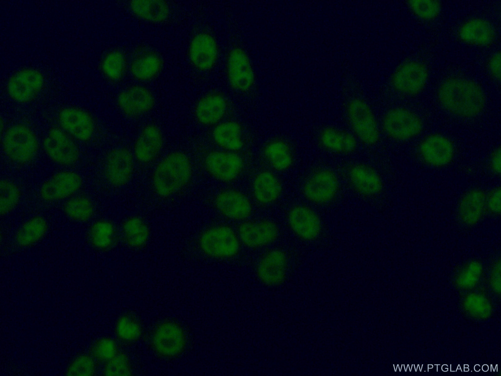 Immunofluorescence (IF) / fluorescent staining of HeLa cells using SBNO1 Polyclonal antibody (25359-1-AP)