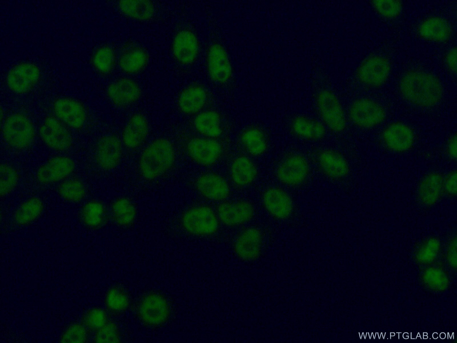 Immunofluorescence (IF) / fluorescent staining of HeLa cells using SBNO1 Polyclonal antibody (25359-1-AP)