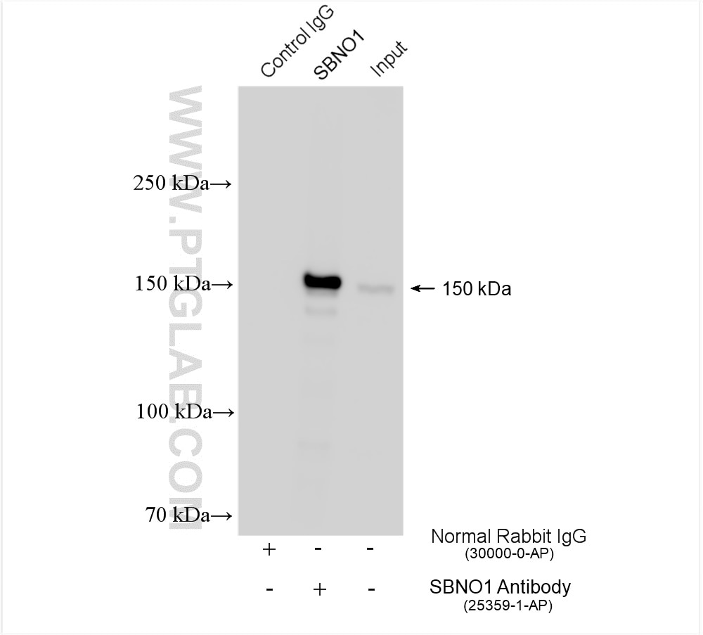 Immunoprecipitation (IP) experiment of Jurkat cells using SBNO1 Polyclonal antibody (25359-1-AP)