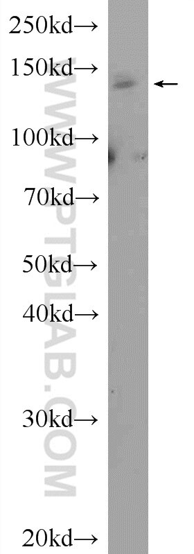 Western Blot (WB) analysis of mouse brain tissue using SBNO1 Polyclonal antibody (25359-1-AP)