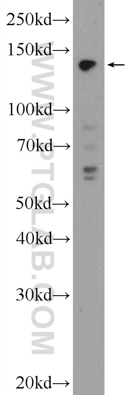 Western Blot (WB) analysis of Raji cells using SBNO1 Polyclonal antibody (25359-1-AP)