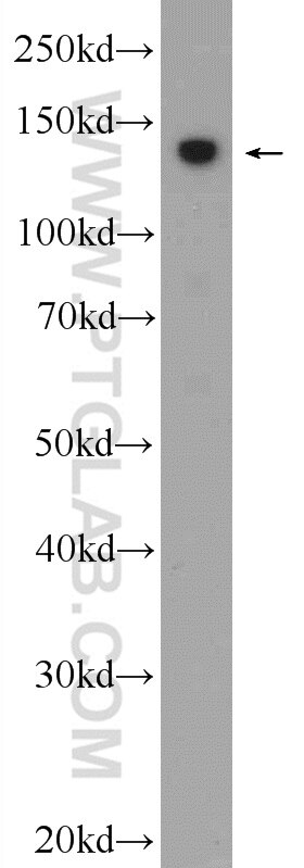 Western Blot (WB) analysis of Jurkat cells using SBNO1 Polyclonal antibody (25359-1-AP)