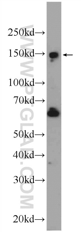 Western Blot (WB) analysis of HeLa cells using SBNO1 Polyclonal antibody (25359-1-AP)