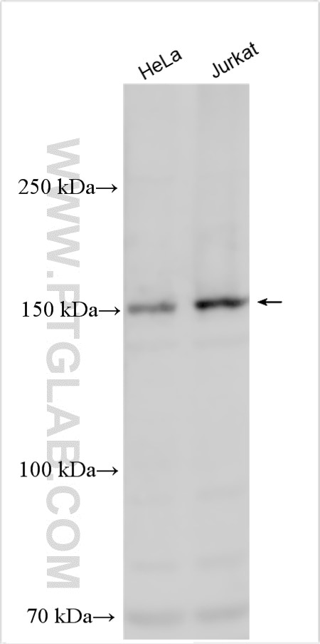 Western Blot (WB) analysis of various lysates using SBNO1 Polyclonal antibody (25359-1-AP)