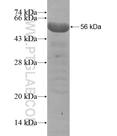SBNO1 fusion protein Ag19005 SDS-PAGE
