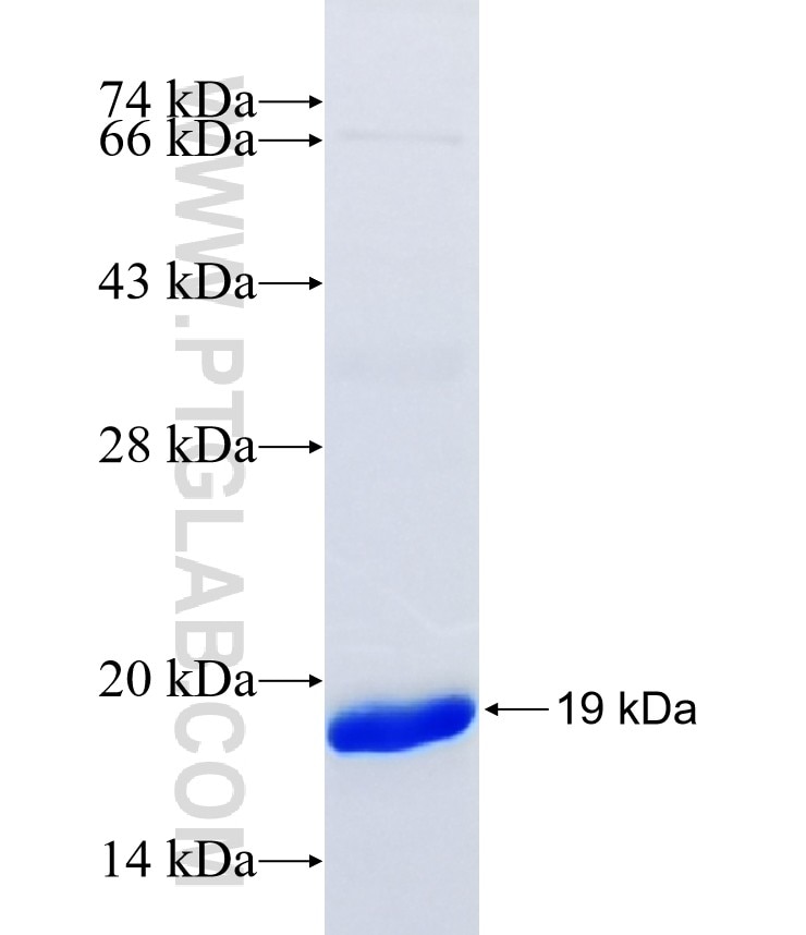 SBNO2 fusion protein Ag41152 SDS-PAGE