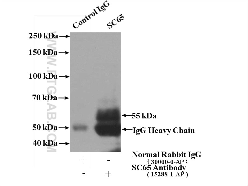 Immunoprecipitation (IP) experiment of mouse bladder tissue using SC65 Polyclonal antibody (15288-1-AP)