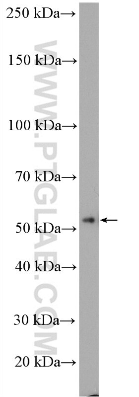 Western Blot (WB) analysis of HeLa cells using SC65 Polyclonal antibody (15288-1-AP)