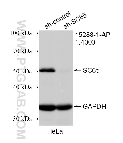 Western Blot (WB) analysis of HeLa cells using SC65 Polyclonal antibody (15288-1-AP)