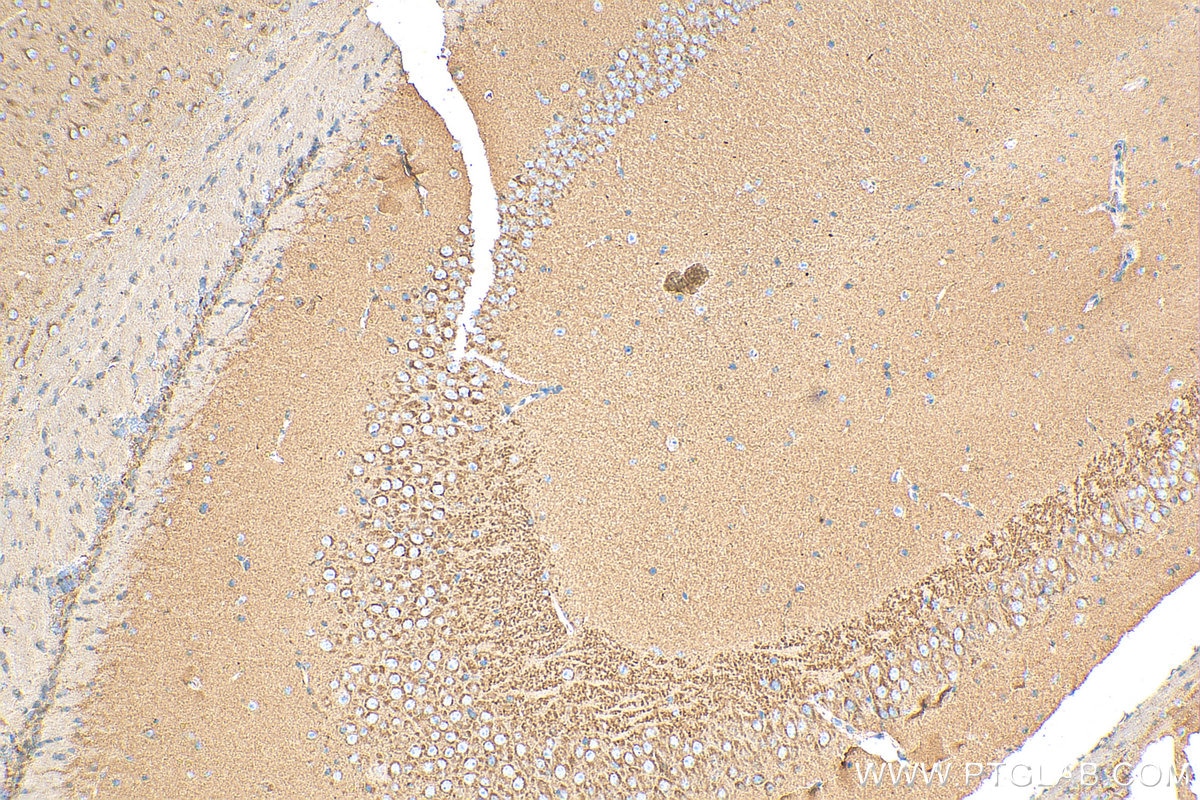 Immunohistochemistry (IHC) staining of mouse brain tissue using SCAMP1 Polyclonal antibody (15327-1-AP)