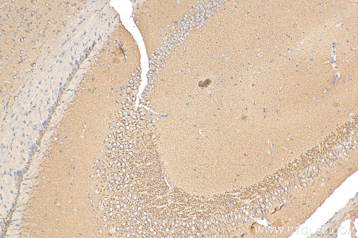 IHC staining of mouse brain using 15327-1-AP