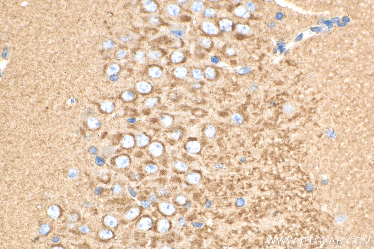 Immunohistochemistry (IHC) staining of mouse brain tissue using SCAMP1 Polyclonal antibody (15327-1-AP)