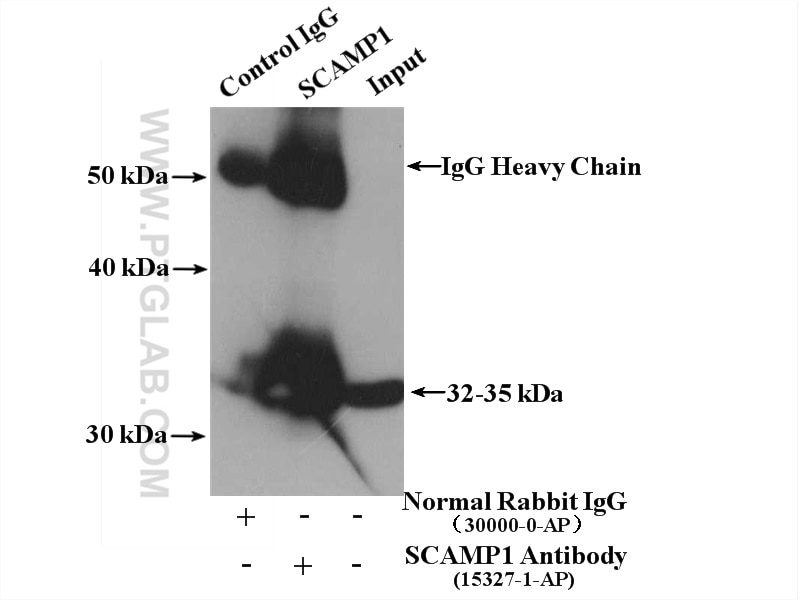 Immunoprecipitation (IP) experiment of mouse brain tissue using SCAMP1 Polyclonal antibody (15327-1-AP)
