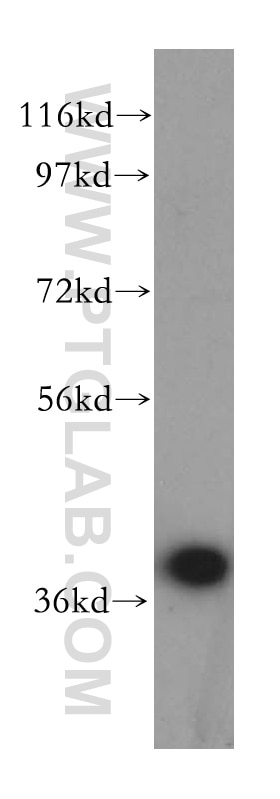 Western Blot (WB) analysis of mouse pancreas tissue using SCAMP1 Polyclonal antibody (15327-1-AP)