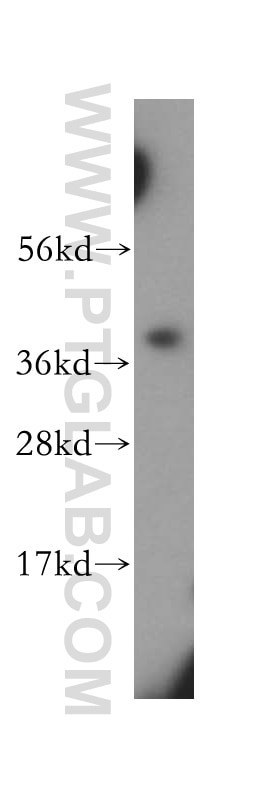 Western Blot (WB) analysis of HeLa cells using SCAMP1 Polyclonal antibody (15327-1-AP)