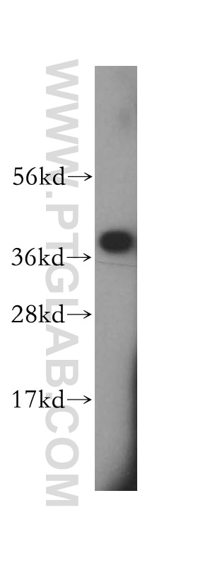 Western Blot (WB) analysis of mouse brain tissue using SCAMP1 Polyclonal antibody (15327-1-AP)