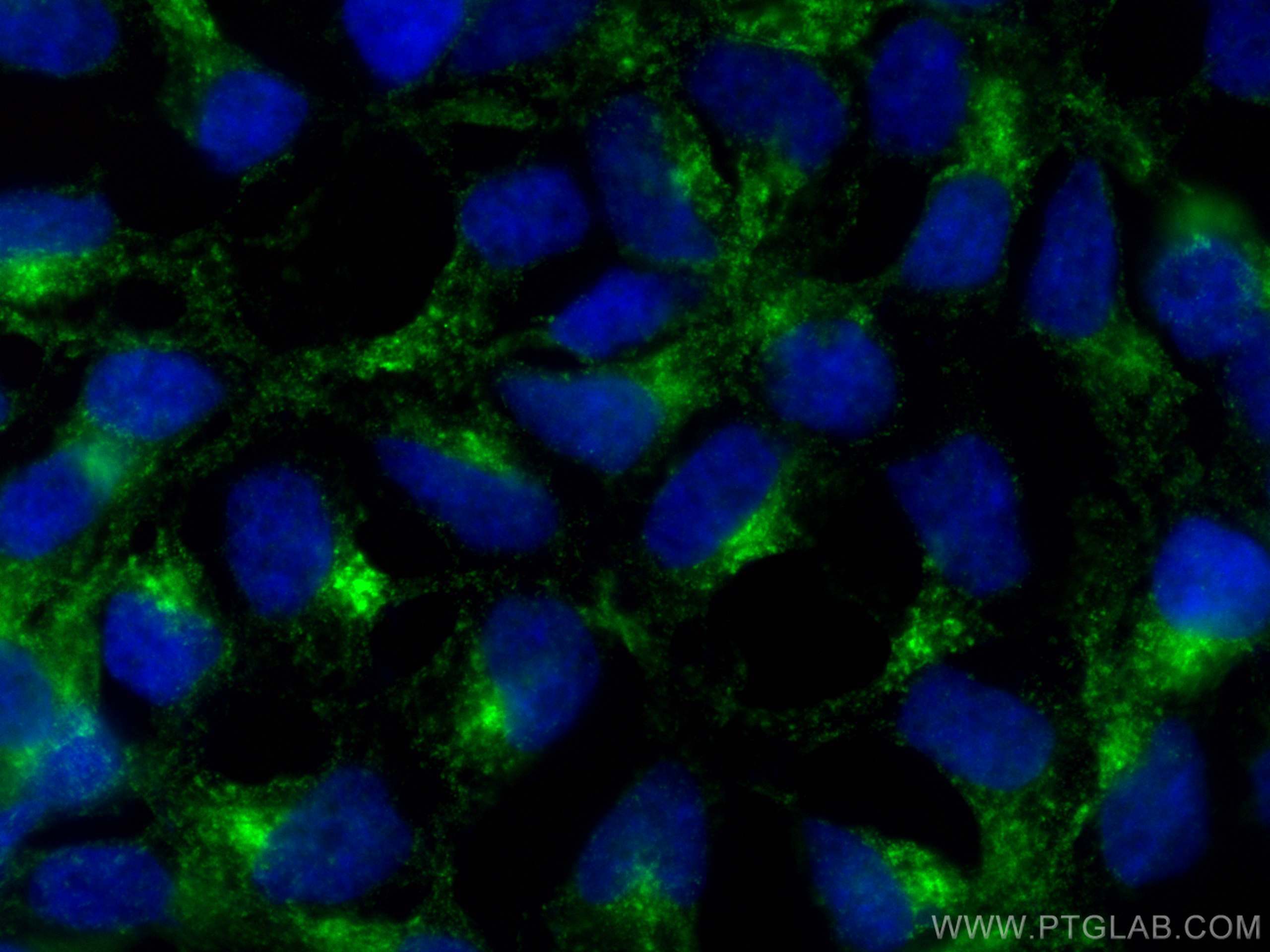 Immunofluorescence (IF) / fluorescent staining of HEK-293 cells using SCAMP2 Polyclonal antibody (15119-1-AP)