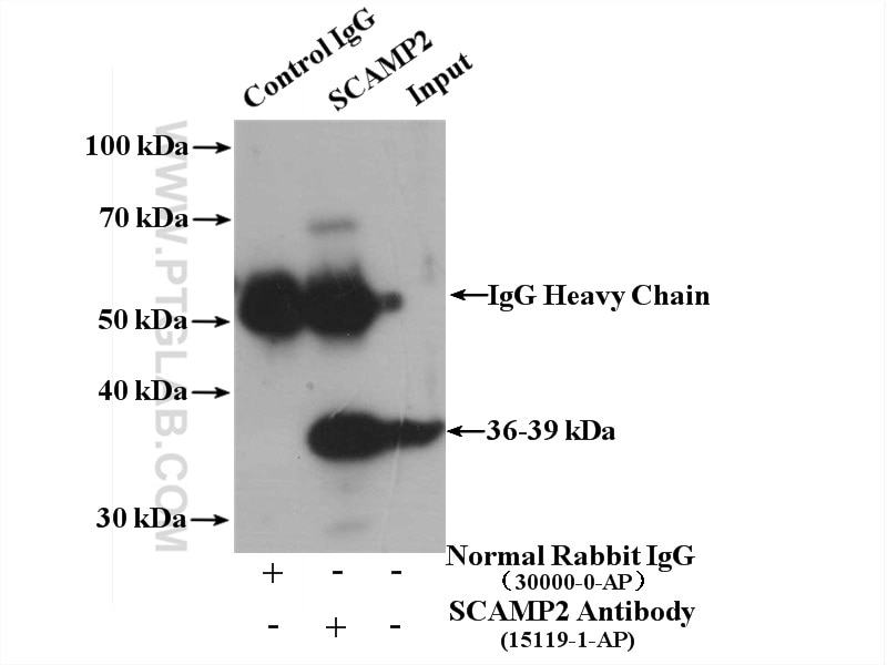 Immunoprecipitation (IP) experiment of HepG2 cells using SCAMP2 Polyclonal antibody (15119-1-AP)