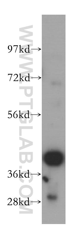 Western Blot (WB) analysis of HeLa cells using SCAMP2 Polyclonal antibody (15119-1-AP)