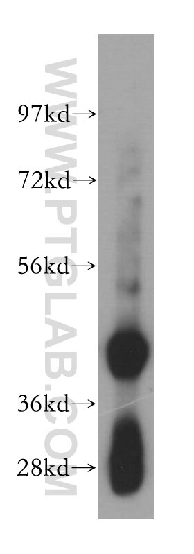 Western Blot (WB) analysis of human liver tissue using SCAMP2 Polyclonal antibody (15119-1-AP)