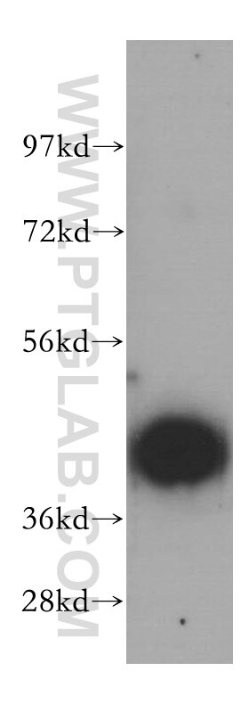 WB analysis of HepG2 using 15119-1-AP