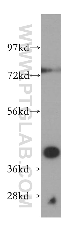 Western Blot (WB) analysis of mouse lung tissue using SCAMP2 Polyclonal antibody (15119-1-AP)