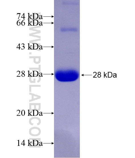 SCAMP2 fusion protein Ag28866 SDS-PAGE