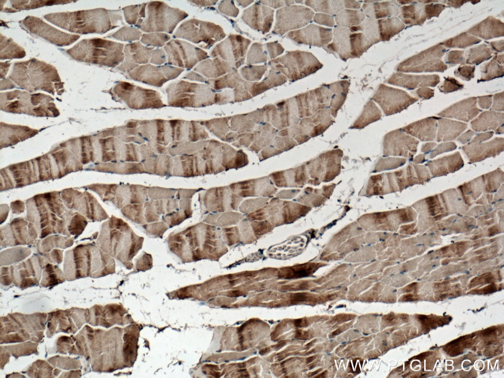 Immunohistochemistry (IHC) staining of mouse skeletal muscle tissue using SCAMP3 Polyclonal antibody (26888-1-AP)