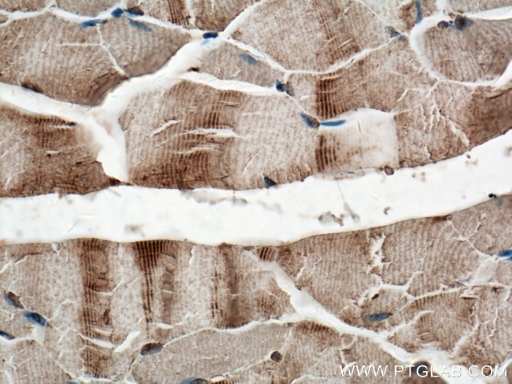 Immunohistochemistry (IHC) staining of mouse skeletal muscle tissue using SCAMP3 Polyclonal antibody (26888-1-AP)