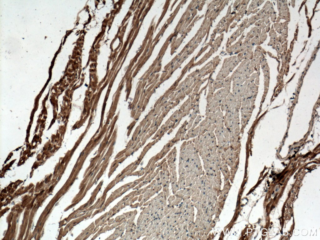 IHC staining of mouse heart using 26888-1-AP