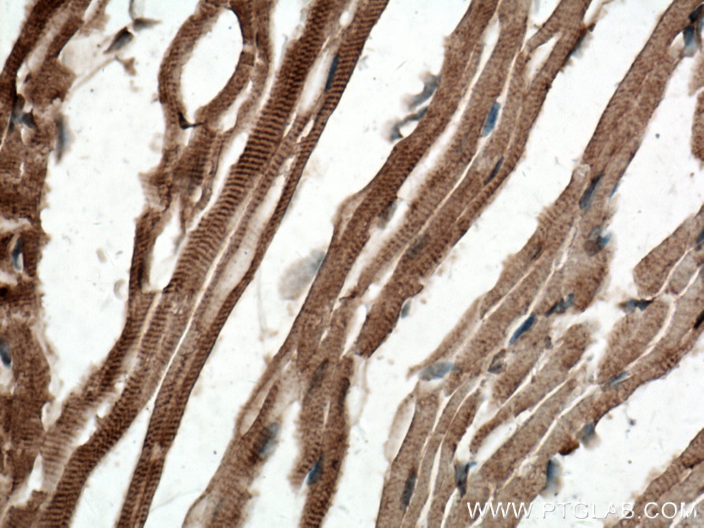 Immunohistochemistry (IHC) staining of mouse heart tissue using SCAMP3 Polyclonal antibody (26888-1-AP)
