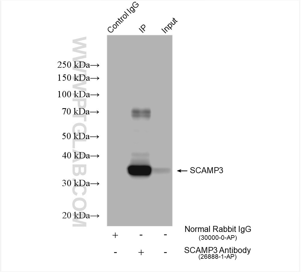 Immunoprecipitation (IP) experiment of HepG2 cells using SCAMP3 Polyclonal antibody (26888-1-AP)