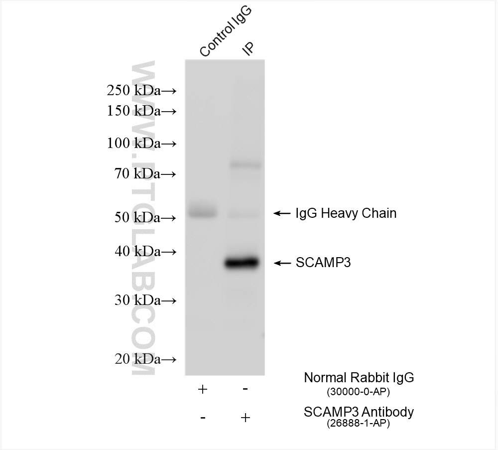 Immunoprecipitation (IP) experiment of mouse heart tissue using SCAMP3 Polyclonal antibody (26888-1-AP)