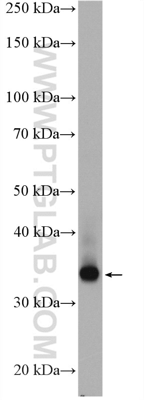 Western Blot (WB) analysis of A549 cells using SCAMP3 Polyclonal antibody (26888-1-AP)