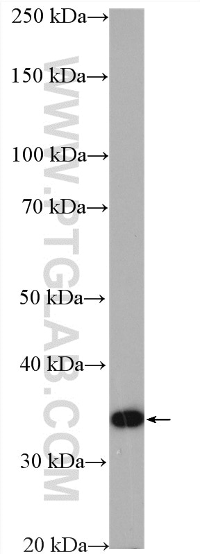 Western Blot (WB) analysis of K-562 cells using SCAMP3 Polyclonal antibody (26888-1-AP)
