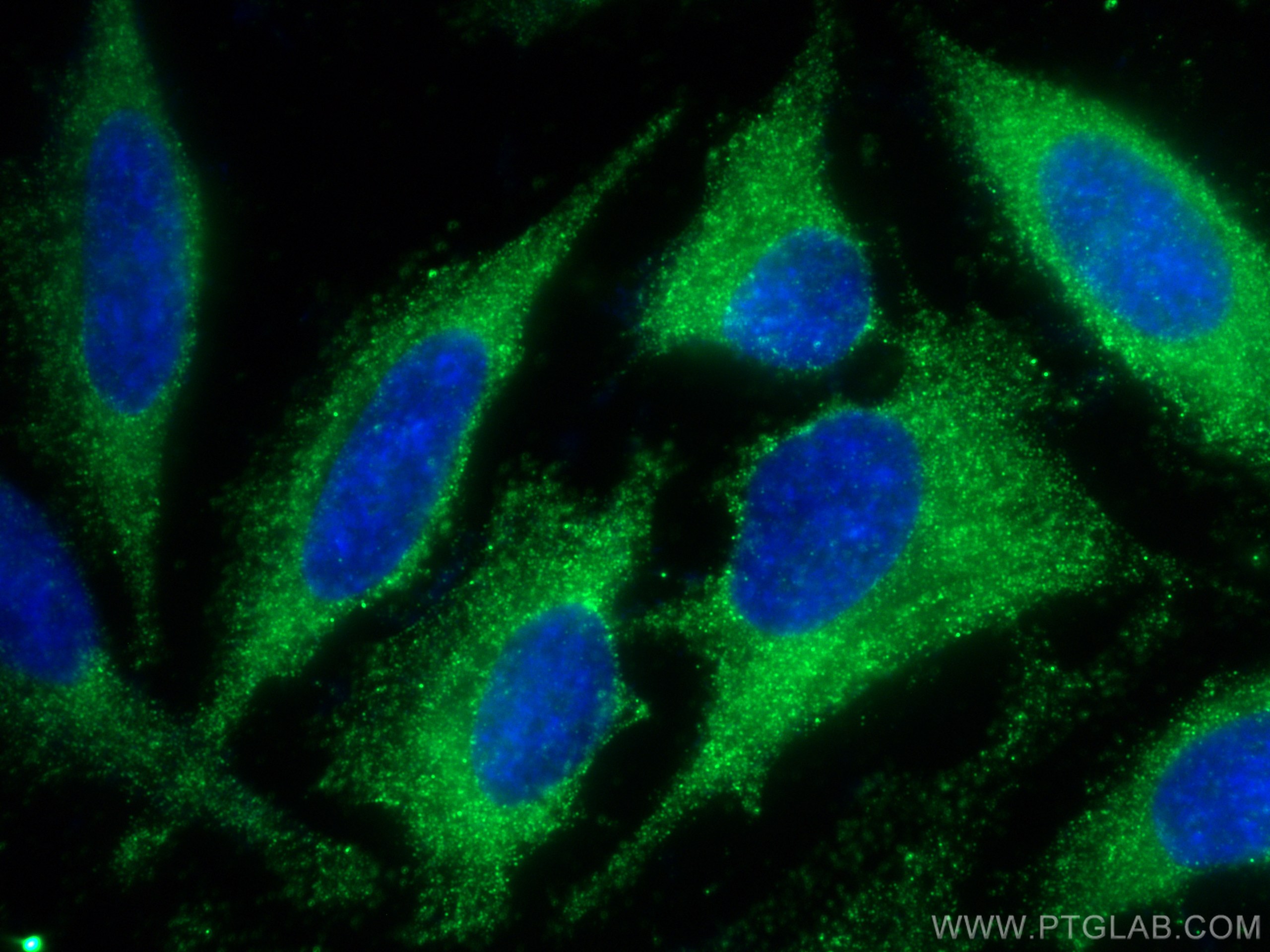 Immunofluorescence (IF) / fluorescent staining of HeLa cells using SCAMP3 Monoclonal antibody (67932-1-Ig)
