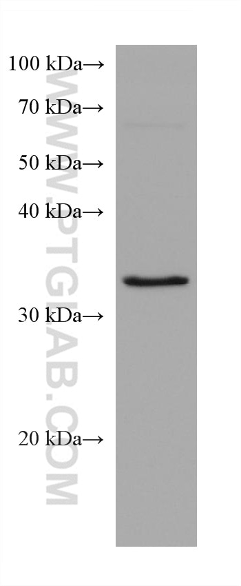 Western Blot (WB) analysis of LNCaP cells using SCAMP3 Monoclonal antibody (67932-1-Ig)