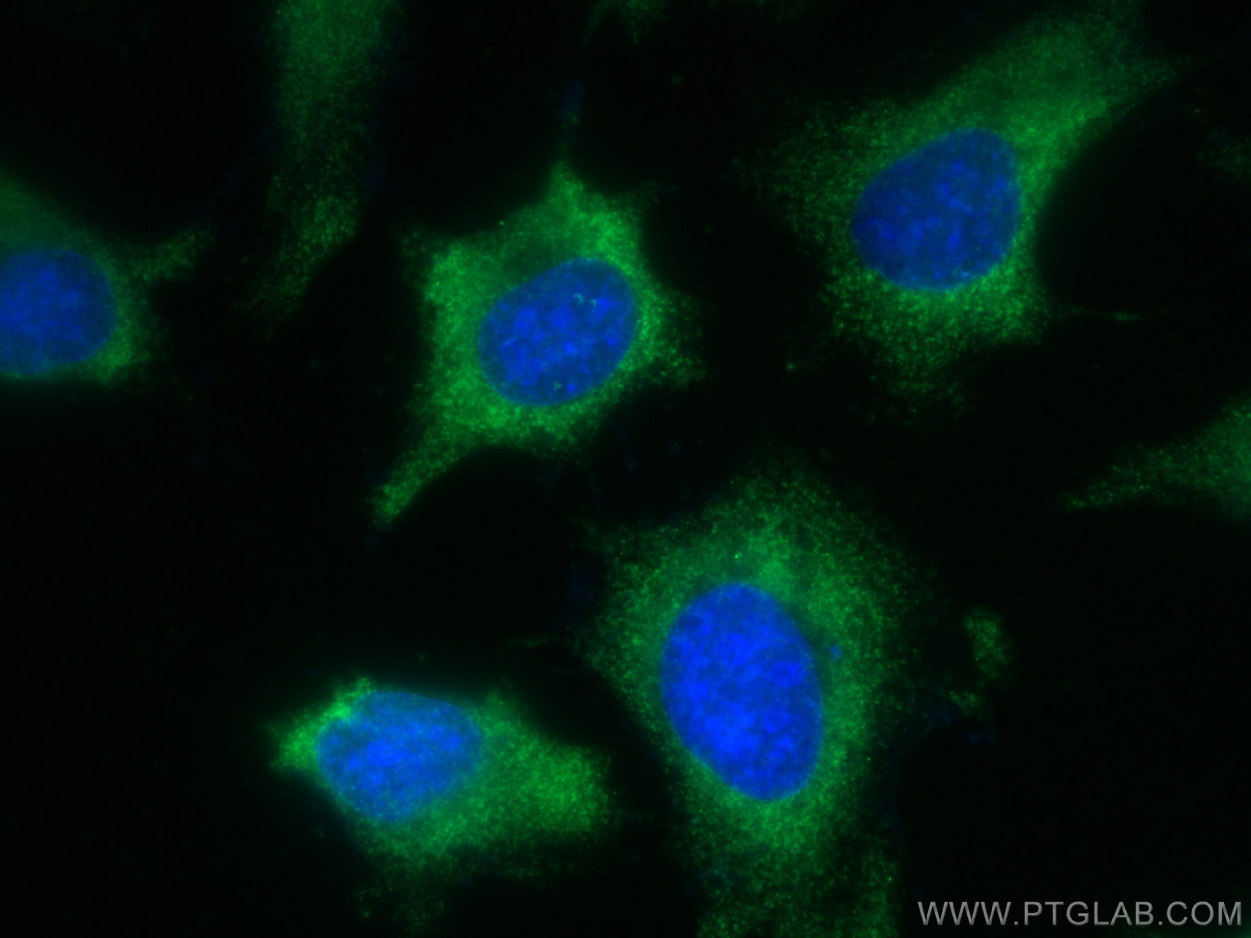 Immunofluorescence (IF) / fluorescent staining of HeLa cells using CoraLite® Plus 488-conjugated SCAMP3 Monoclonal an (CL488-67932)