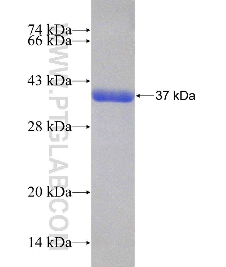 SCAMP3 fusion protein Ag25256 SDS-PAGE
