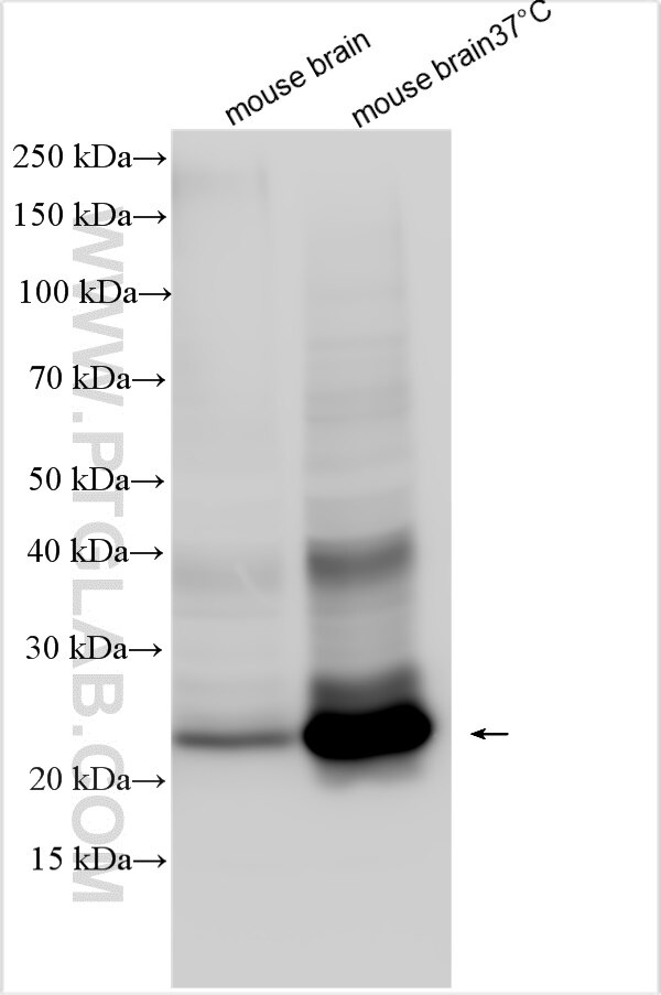 Western Blot (WB) analysis of various lysates using SCAMP5 Polyclonal antibody (30328-1-AP)